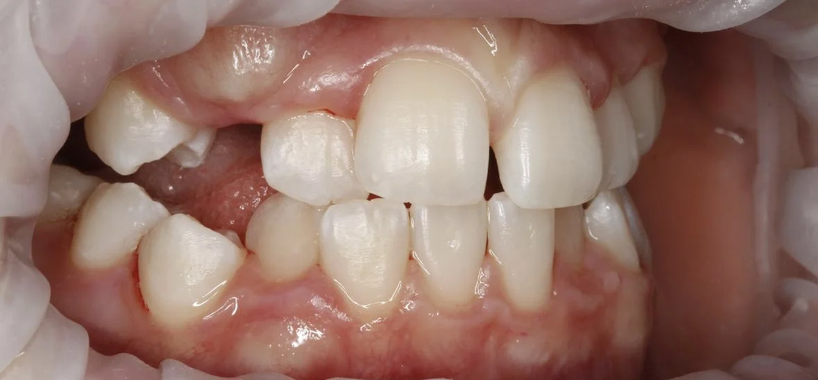 Dentální hygiena