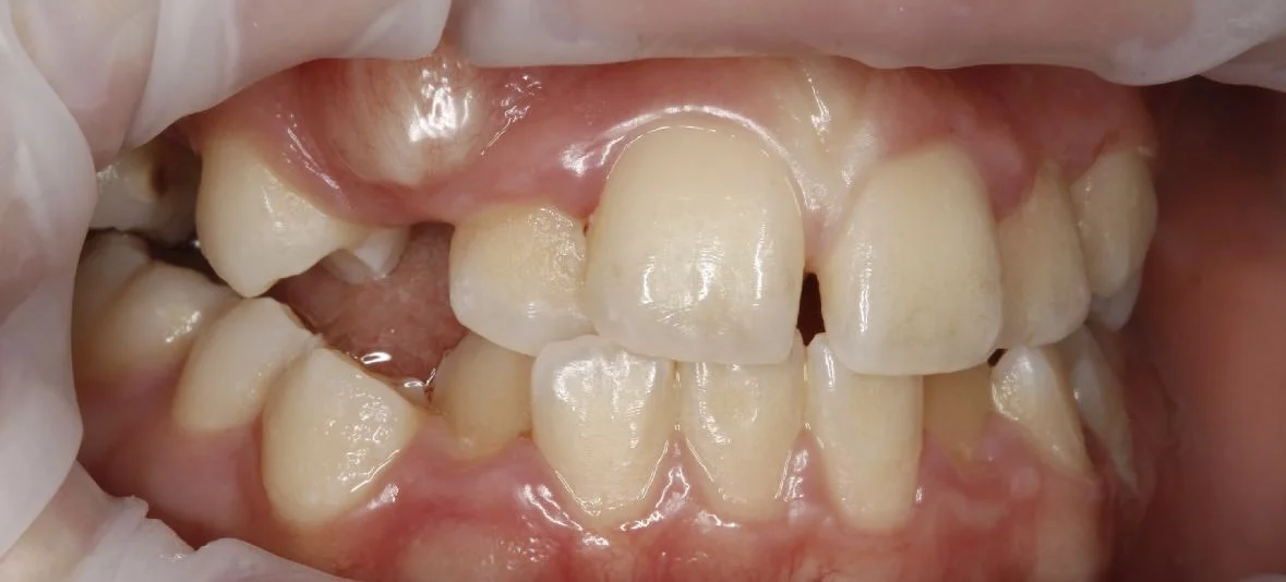 Dentální hygiena