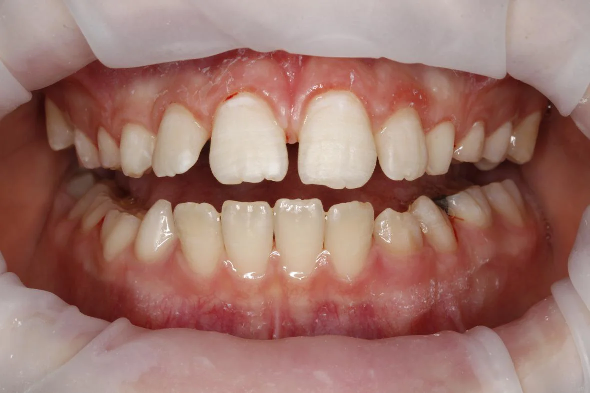 Dentální hygiena