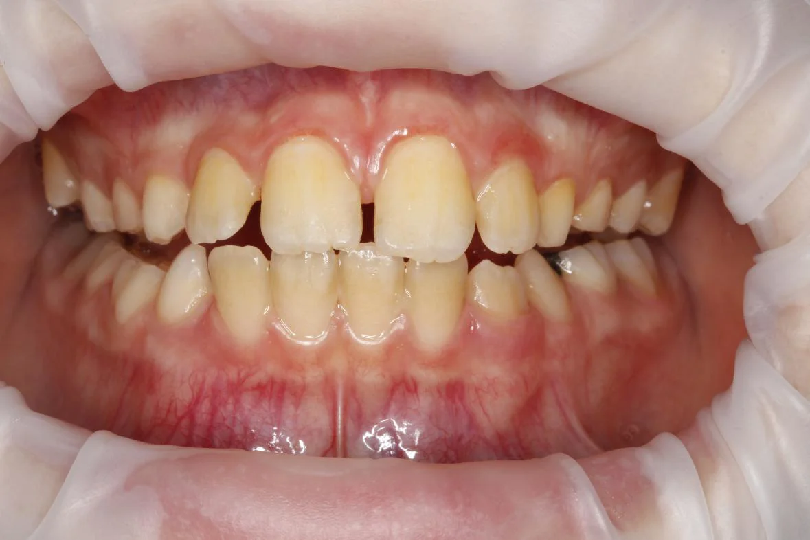 Dentální hygiena