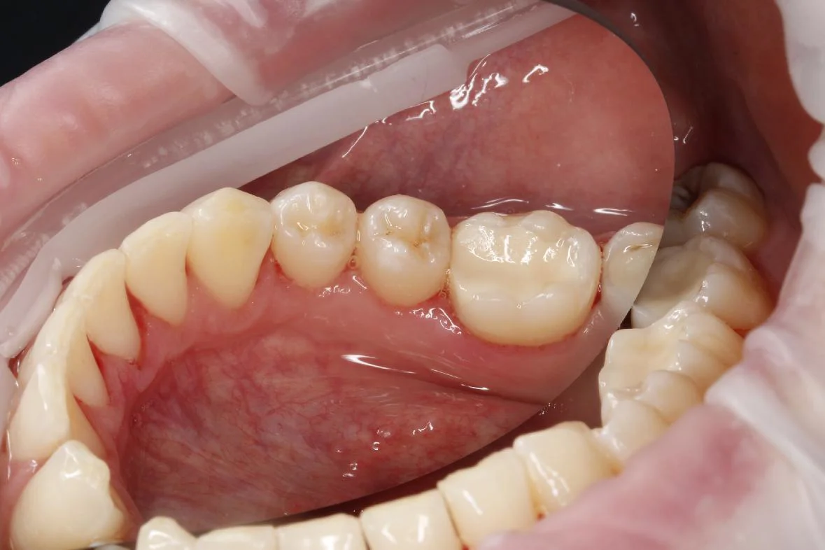 Dentální hygiena